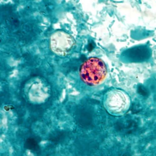 Cyclospora.  Image: Melanie Moser, provided by the CDC in 2014...